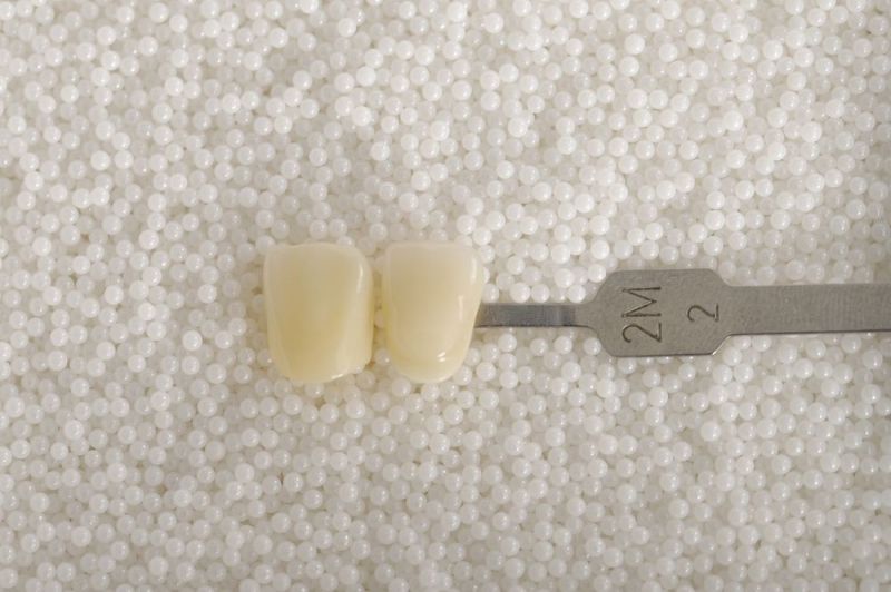 Classification and clinical application of oral ceramics and ceramic like restorative materials