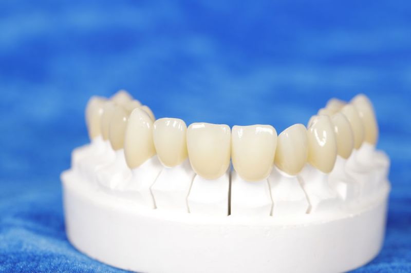 What role does gas-phase silica play in dental ceramics?