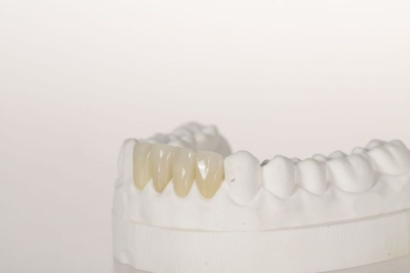 Ceramic materials for oral implantation